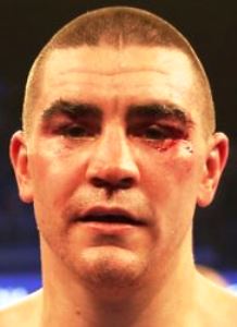 Johnny Garton